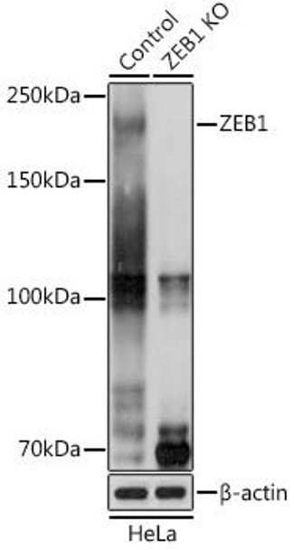 KO Validated Antibodies 1 Anti-ZEB1 Antibody CAB1500KO Validated
