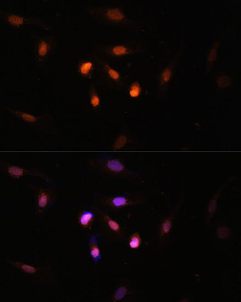 Epigenetics and Nuclear Signaling Antibodies 2 Anti-KAT6A Antibody CAB15006