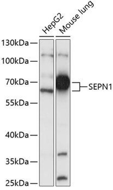 Cell Biology Antibodies 5 Anti-SEPN1 Antibody CAB15012