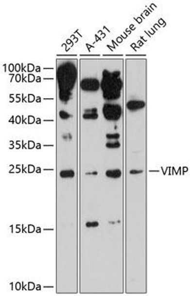 Cell Biology Antibodies 5 Anti-VIMP Antibody CAB15013