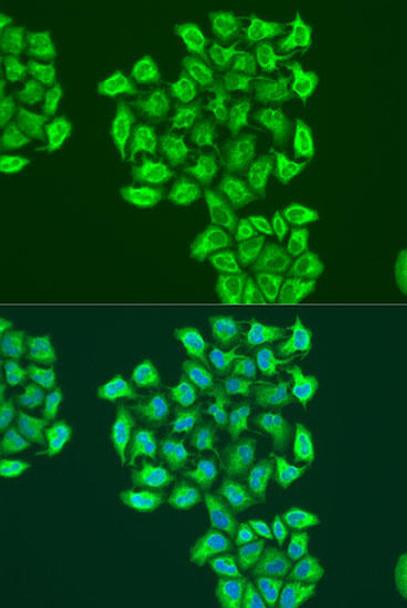 Cell Death Antibodies 1 Anti-BNIP3 Antibody CAB15032