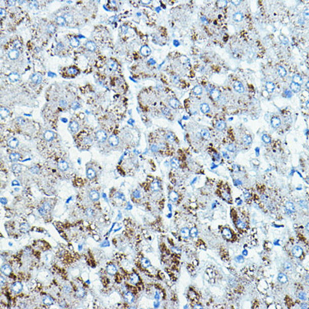 Cell Biology Antibodies 5 Anti-BRAF Antibody CAB15033