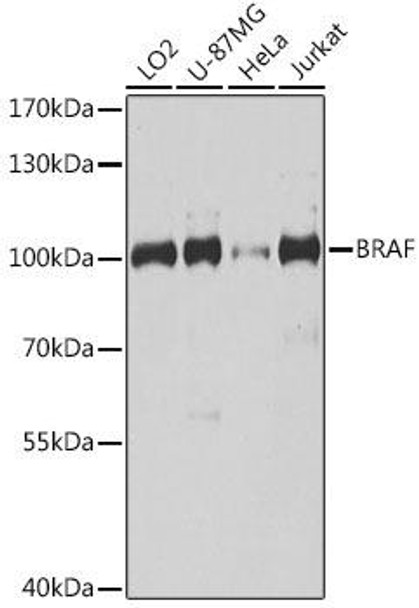 Cell Biology Antibodies 5 Anti-BRAF Antibody CAB15033