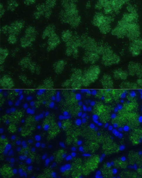 Cell Biology Antibodies 5 Anti-CTRB1 Antibody CAB15043