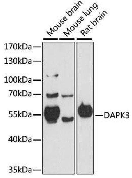 Cell Death Antibodies 1 Anti-DAPK3 Antibody CAB15047