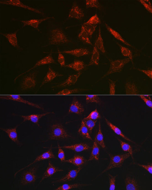 Cell Biology Antibodies 5 Anti-DCN Antibody CAB15048