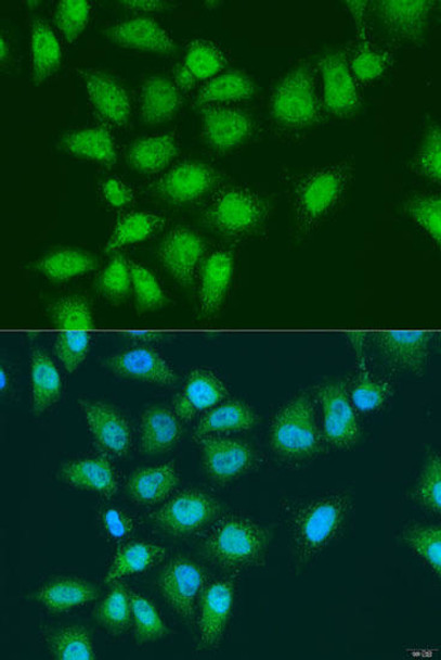 Epigenetics and Nuclear Signaling Antibodies 2 Anti-EYA3 Antibody CAB15056