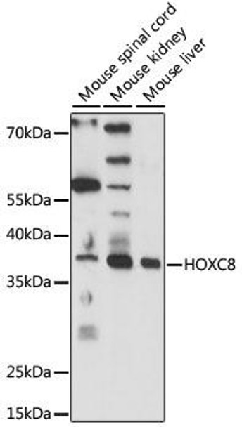 Epigenetics and Nuclear Signaling Antibodies 2 Anti-HOXC8 Antibody CAB15066