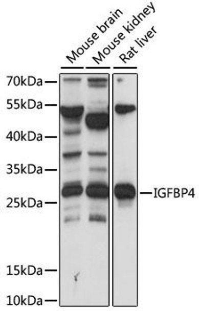 Cell Biology Antibodies 5 Anti-IGFBP4 Antibody CAB15068