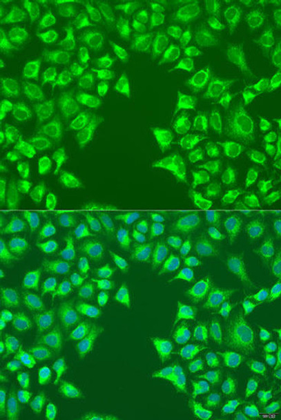 Cell Biology Antibodies 5 Anti-LRP6 Antibody CAB15070