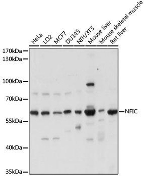 Epigenetics and Nuclear Signaling Antibodies 2 Anti-NFIC Antibody CAB15074