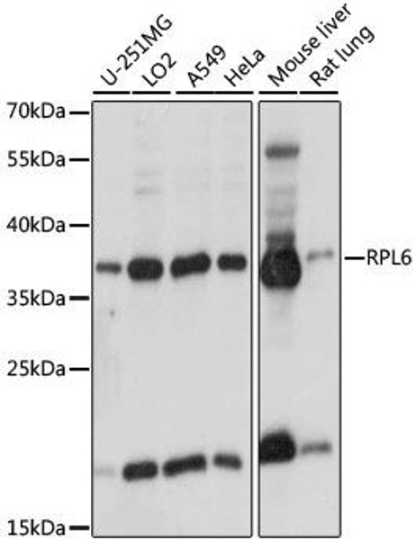 Cell Biology Antibodies 5 Anti-RPL6 Antibody CAB15094