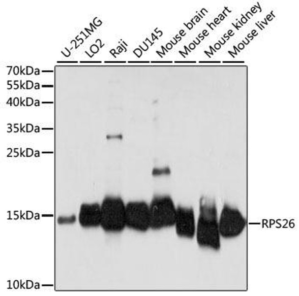 Epigenetics and Nuclear Signaling Antibodies 2 Anti-RPS26 Antibody CAB15096