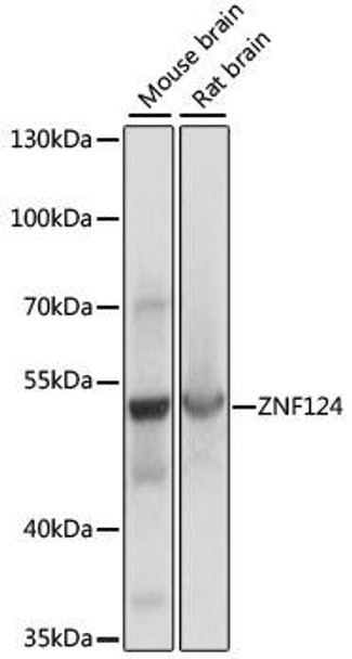 Epigenetics and Nuclear Signaling Antibodies 2 Anti-ZNF124 Antibody CAB15111