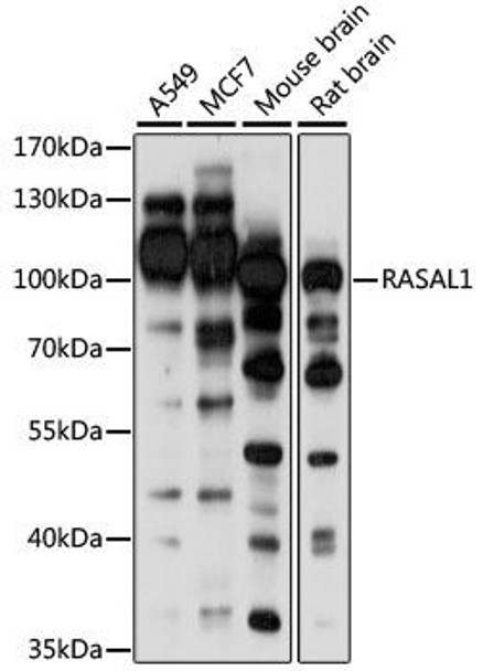 Developmental Biology Anti-RASAL1 Antibody CAB15114