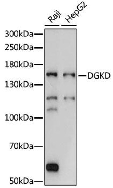 Cell Biology Antibodies 5 Anti-DGKD Antibody CAB15115