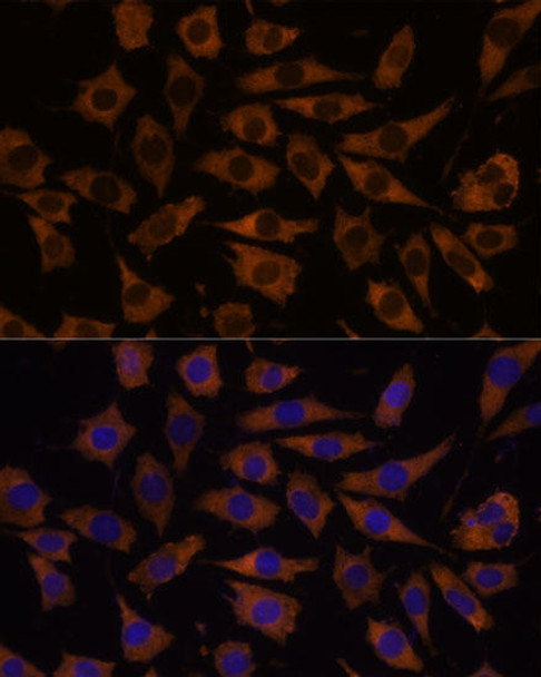 Metabolism Antibodies 1 Anti-EIF5B Antibody CAB15123