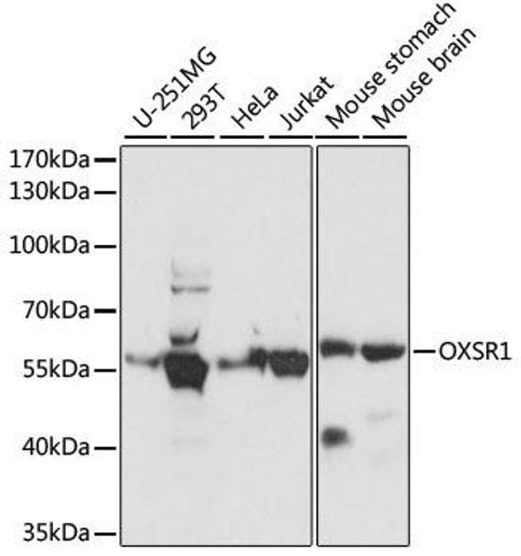 Cell Biology Antibodies 5 Anti-OXSR1 Antibody CAB15126