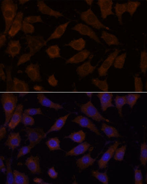 Cell Biology Antibodies 5 Anti-OXSR1 Antibody CAB15126