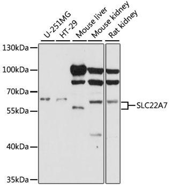 Signal Transduction Antibodies 2 Anti-SLC22A7 Antibody CAB15137