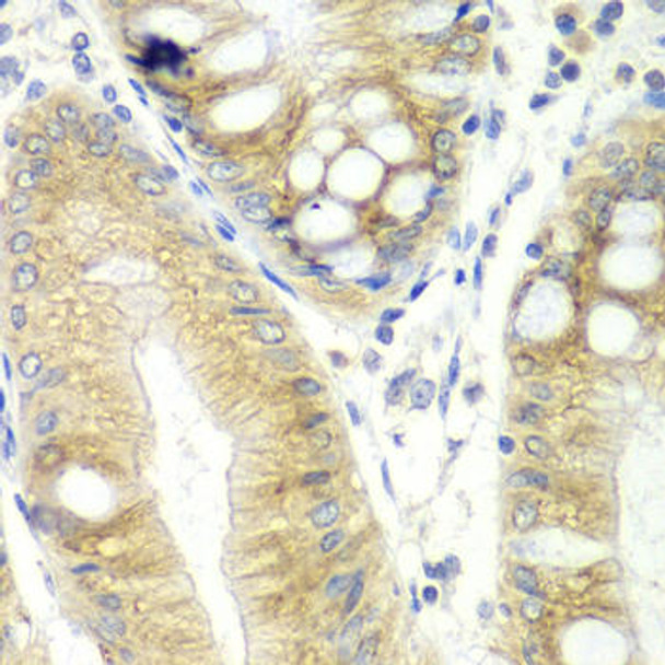 Cell Biology Antibodies 5 Anti-CES2 Antibody CAB1514