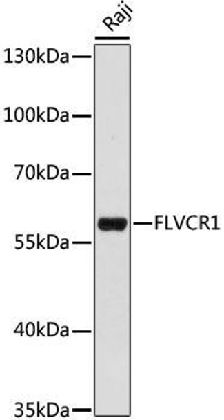 Immunology Antibodies 1 Anti-FLVCR1 Antibody CAB15153