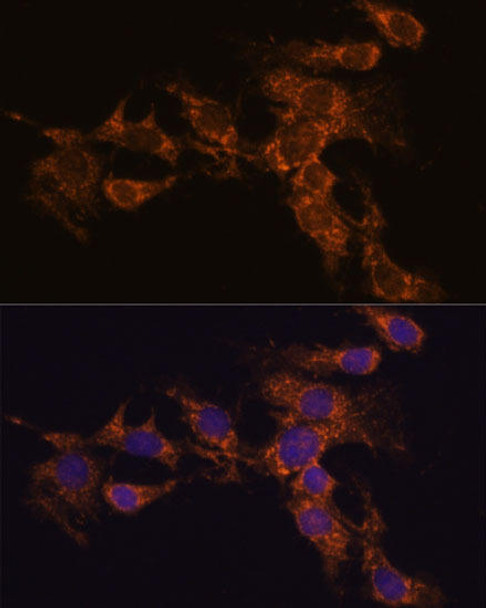 Metabolism Antibodies 1 Anti-PYCR2 Antibody CAB15155