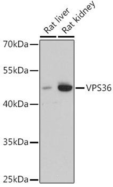 Cell Biology Antibodies 5 Anti-VPS36 Antibody CAB15157