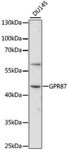 Cell Biology Antibodies 5 Anti-GPR87 Antibody CAB15162