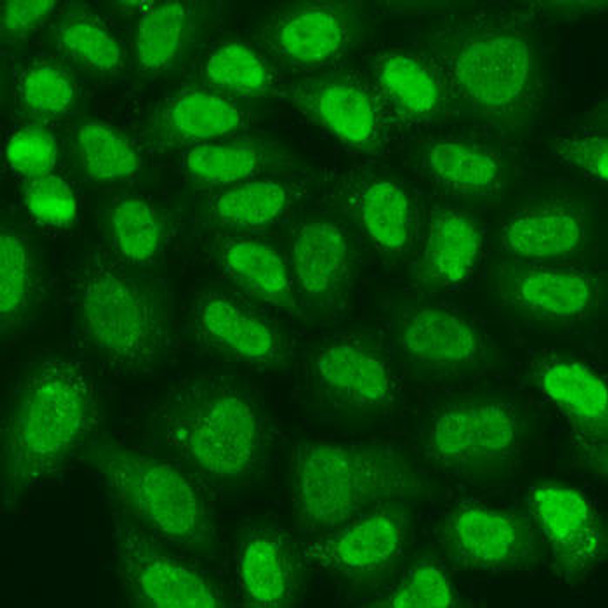 Epigenetics and Nuclear Signaling Antibodies 2 Anti-TERF2IP Antibody CAB15163