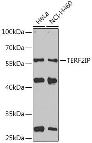 Epigenetics and Nuclear Signaling Antibodies 2 Anti-TERF2IP Antibody CAB15163