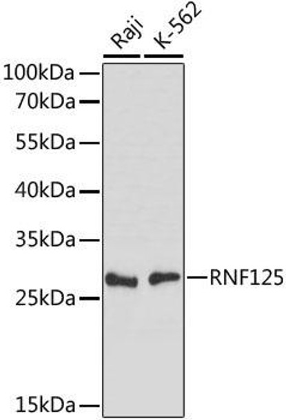 Immunology Antibodies 1 Anti-RNF125 Antibody CAB15166