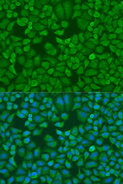 Epigenetics and Nuclear Signaling Antibodies 2 Anti-IGF2BP1 Antibody CAB1517