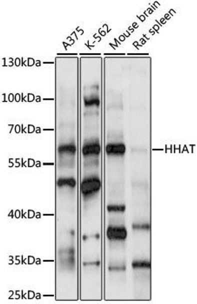 Cell Biology Antibodies 5 Anti-HHAT Antibody CAB15171