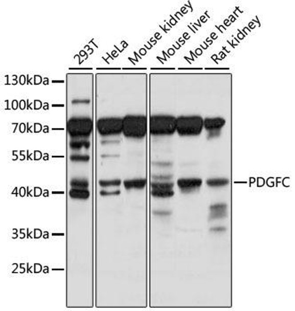 Cell Biology Antibodies 5 Anti-PDGFC Antibody CAB15174