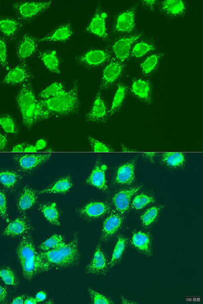 Cell Biology Antibodies 5 Anti-MCCC2 Antibody CAB15181