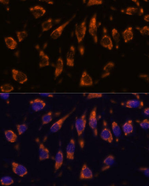 Cell Biology Antibodies 5 Anti-CRELD1 Antibody CAB15186