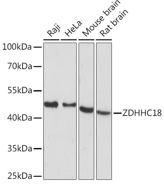 Cell Biology Antibodies 5 Anti-ZDHHC18 Antibody CAB15199