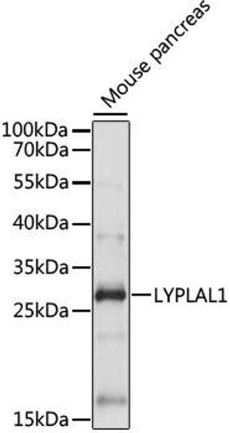 Cell Biology Antibodies 5 Anti-LYPLAL1 Antibody CAB15209