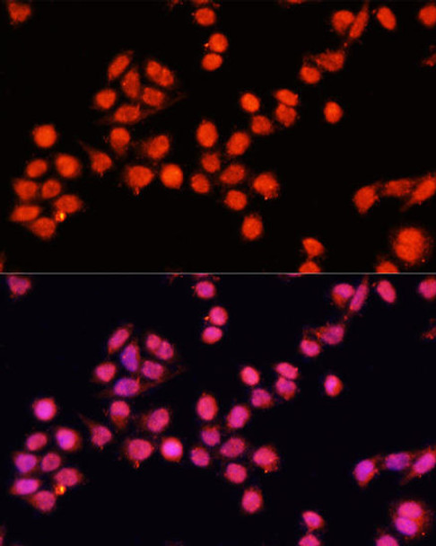 Signal Transduction Antibodies 2 Anti-SLC24A5 Antibody CAB15223
