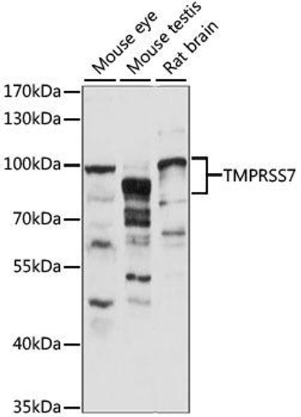 Signal Transduction Antibodies 2 Anti-TMPRSS7 Antibody CAB15225