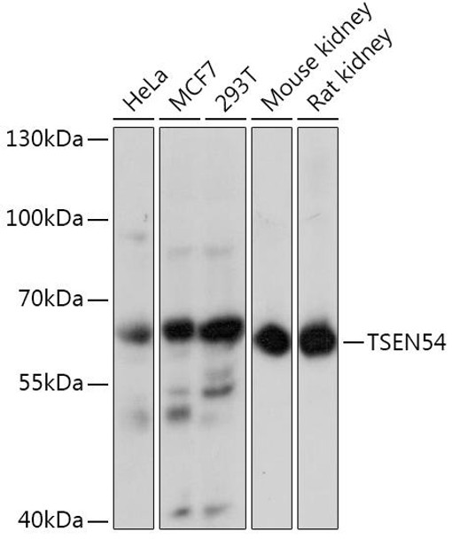 Epigenetics and Nuclear Signaling Antibodies 2 Anti-TSEN54 Antibody CAB15227