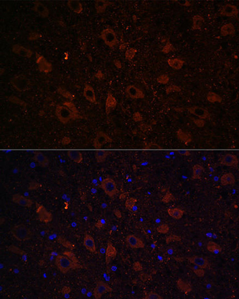 Neuroscience Anti-SLC6A3 Antibody CAB15236