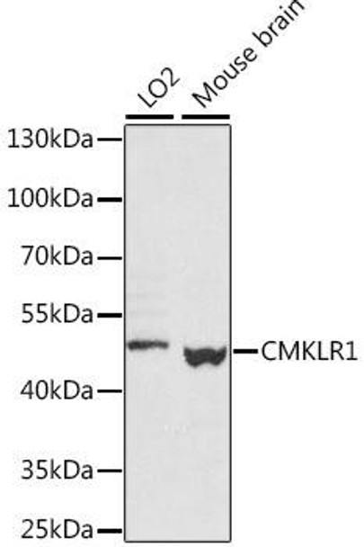 Cell Biology Antibodies 5 Anti-CMKLR1 Antibody CAB15237