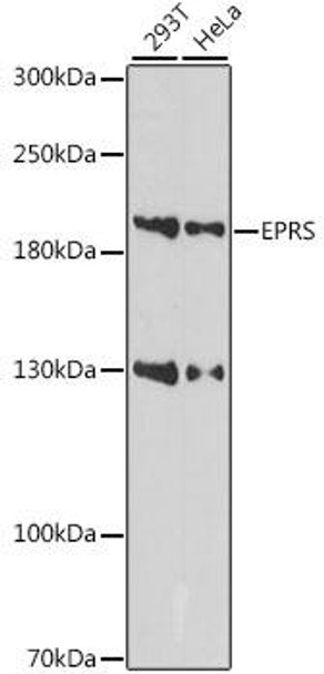 Metabolism Antibodies 1 Anti-EPRS Antibody CAB15245