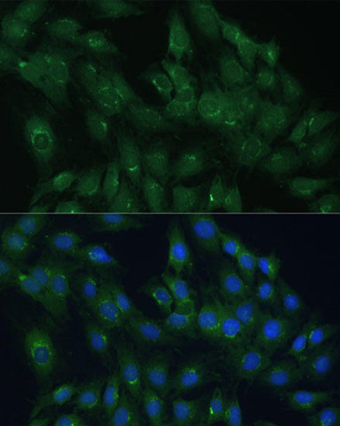 Cell Biology Antibodies 5 Anti-ARL1 Antibody CAB15254