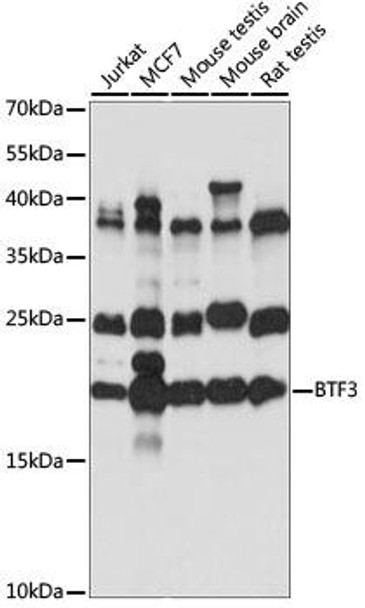 Cell Biology Antibodies 5 Anti-BTF3 Antibody CAB15259