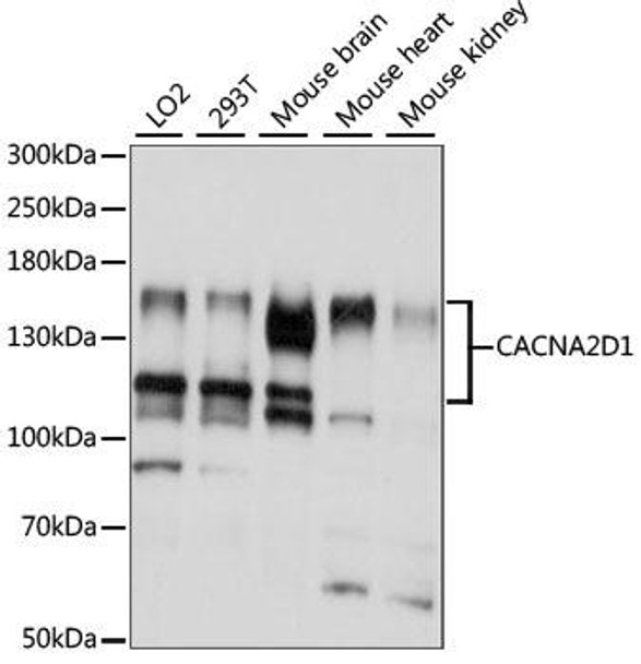 Cell Biology Antibodies 5 Anti-CACNA2D1 Antibody CAB15260