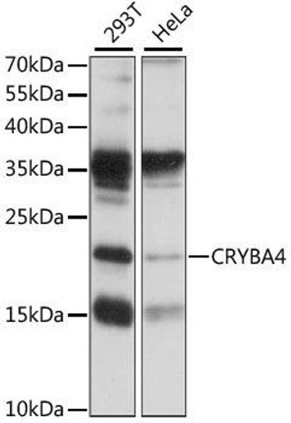 Signal Transduction Antibodies 2 Anti-CRYBA4 Antibody CAB15268