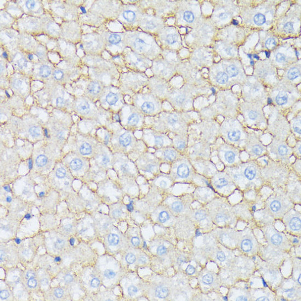 Cell Biology Antibodies 5 Anti-CTNNA2 Antibody CAB15269
